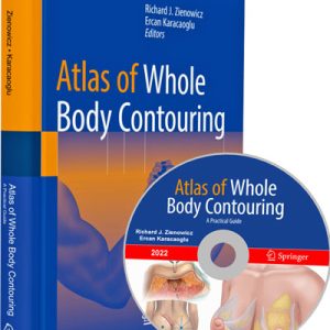 Atlas of Whole Body Contouring A Practical Guide 2022