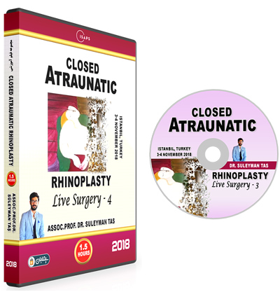 Closed-Atraumatic-Rhinoplasty-2018-03.jpg Closed Atraumatic Rhinoplasty training video course – Turkish edition