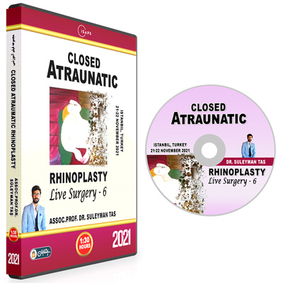 Closed-Atraumatic-Rhinoplasty-2021-06.jpg Closed Atraumatic Rhinoplasty 6 - Image 1