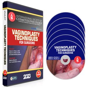 ISCG Vaginoplasty Techniques for Surgeons