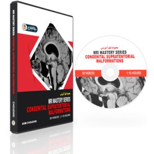 MRI Mastery Series: Congenital Supratentorial Malformations