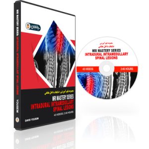 MRI Mastery Series: Intradural Intramedullary Spinal Lesions