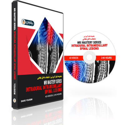 MRI-Mastery-Series-Intradural-Intramedullary-Spinal-Lesions.jpg MRI Mastery Series: Intradural Intramedullary Spinal Lesions - Image 1