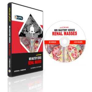 MRI Mastery Series: Renal Masses