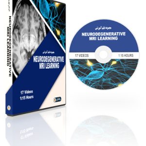 MRI Mastery Series Neurodegenerative MRI Learning Pathway
