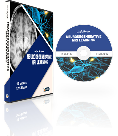 Neurodegenerative-MRI-Learning-Pathway.jpg MRI Mastery Series Neurodegenerative MRI Learning Pathway - Image 1