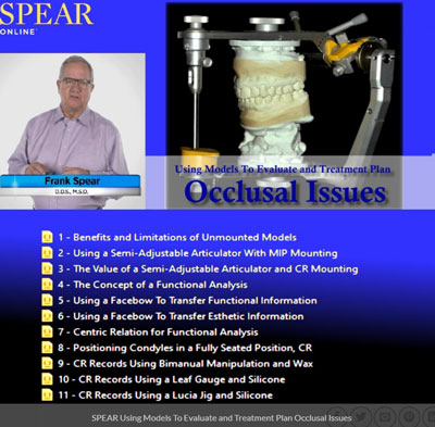 SPEAR-Using-Models-To-Evaluate-and-Treatment-Plan-Occlusal-Issues.jpg SPEAR Using Models To Evaluate and Treatment Plan Occlusal Issues – Frank Spear - Image 1