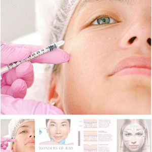Radiesse dermal filler injection training for collagen stimulation – 2025 advanced course