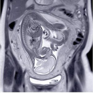 UCSF ObGyn Women’s Imaging 2025 (Videos + Slides PDFs)