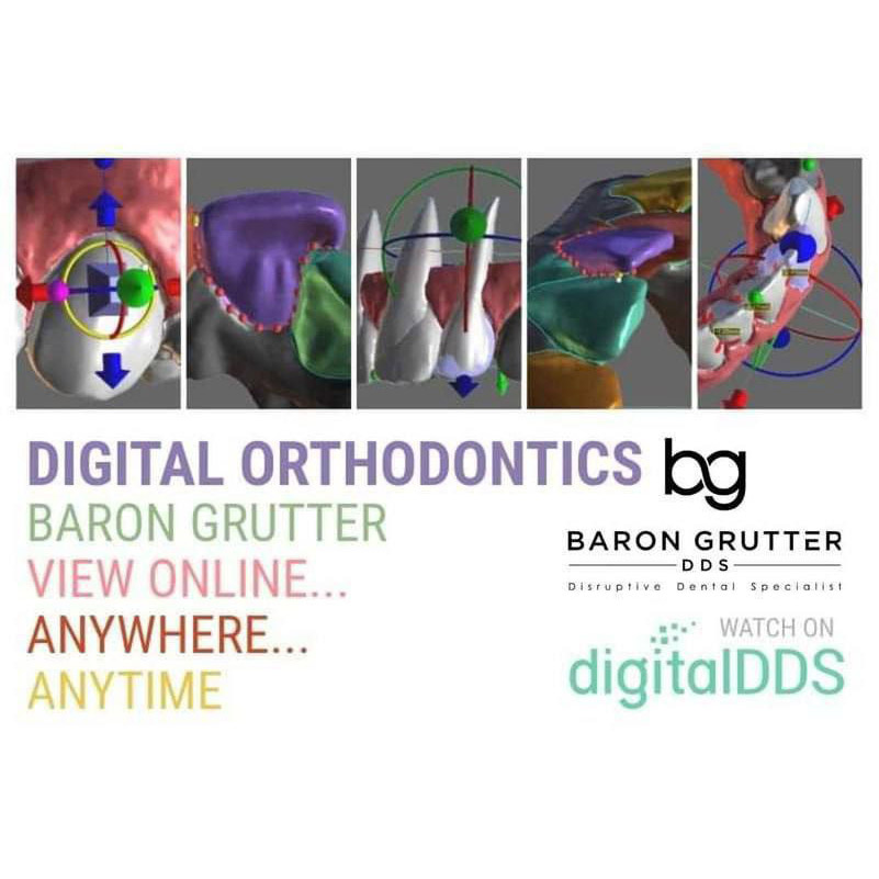 2 2-Day Digital Orthodontics (Live Course Recording) – Baron Grutter, DDS - Image 1