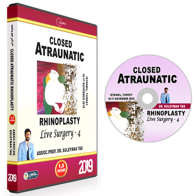 Closed Atraumatic Rhinoplasty 2019 04