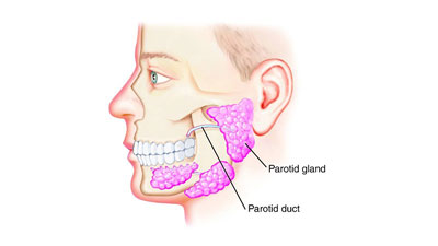 جراحی غده پاروتید یا غدد بزاقی