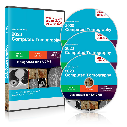 2020-Computed-Tomography-DVD-pack.jpg Computed Tomography: National Symposium 2020 - Image 1