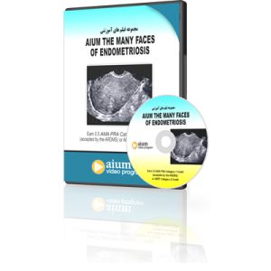 AIUM The Many Faces of Endometriosis
