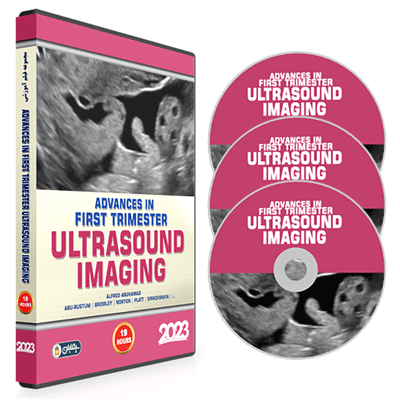 Advances-in-First-Trimester-Ultrasound-Imaging-2023.gif 2023 Advances in First Trimester Ultrasound Imaging – A CME Teaching Activity - Image 1