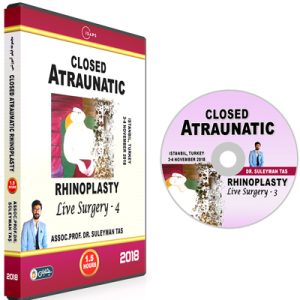 Closed Atraumatic Rhinoplasty 3 (Turkish)