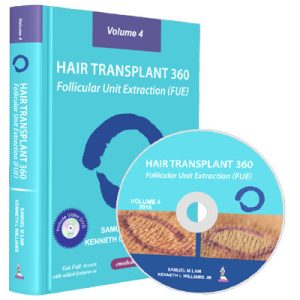 Hair Transplant 360 Follicular Unit Extraction (FUE) Volume 4  2016