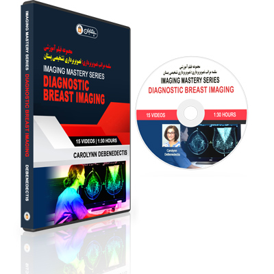 Imaging-Mastery-Series-Diagnostic-Breast-Imaging.jpg Imaging Mastery Series: Diagnostic Breast Imaging - Image 1
