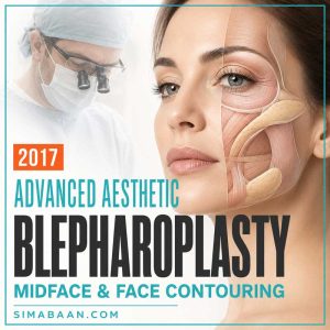advanced-aesthetic-blepharoplasty-midface-face-contouring-2017