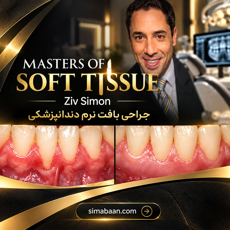masters-of-soft-tissue-ziv-simon-dentistry آموزش جراحی بافت نرم دندانپزشکی Ziv Simon