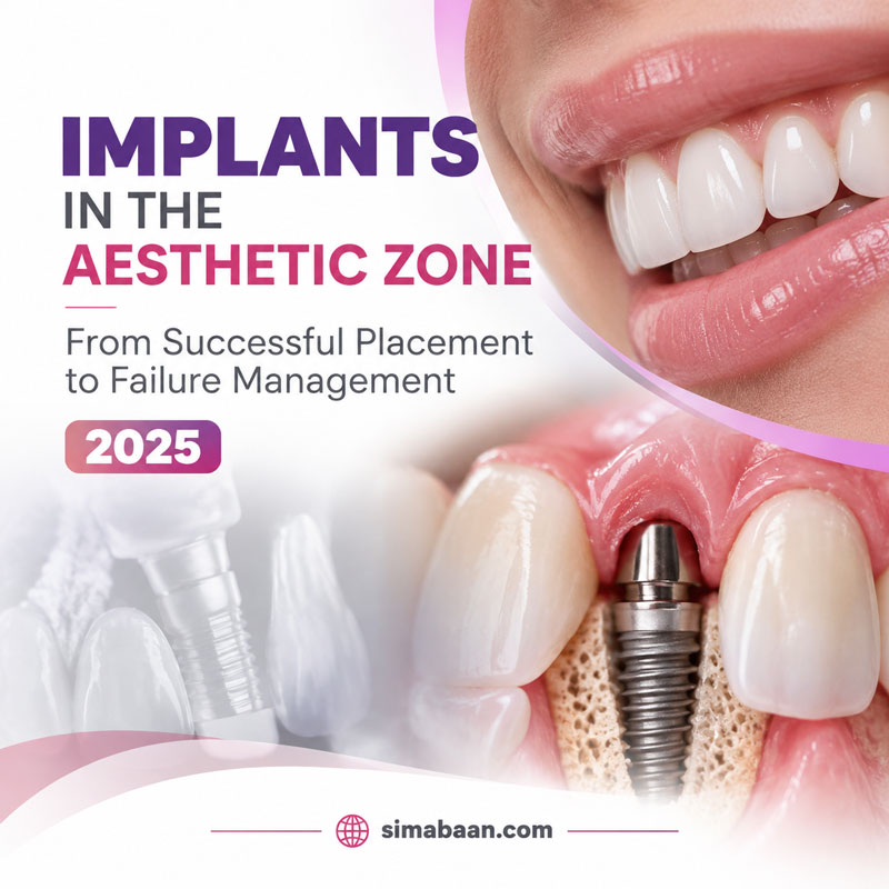 0df9f7cc-1419-49fc-90f4-9219ce580ba8 Implants in the Aesthetic Zone 2025 | آموزش ایمپلنت در ناحیه زیبایی و مدیریت عوارض