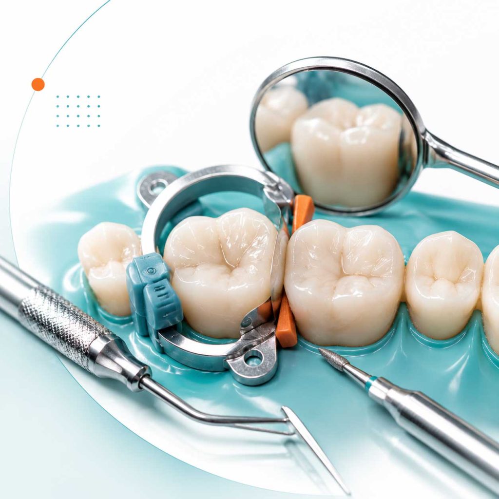 آموزش ترمیم مستقیم دندانهای خلفی و ایجاد کانتکت پوینت