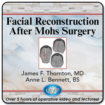 facial-reconstruction-after-mohs-surgery-2025 آموزش بازسازی صورت پس از جراحی موهس