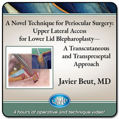 upper-lateral-access-lower-lid-blepharoplasty-2025 آموزش بلفاروپلاستی پلک پایین با تکنیک Upper Lateral Access