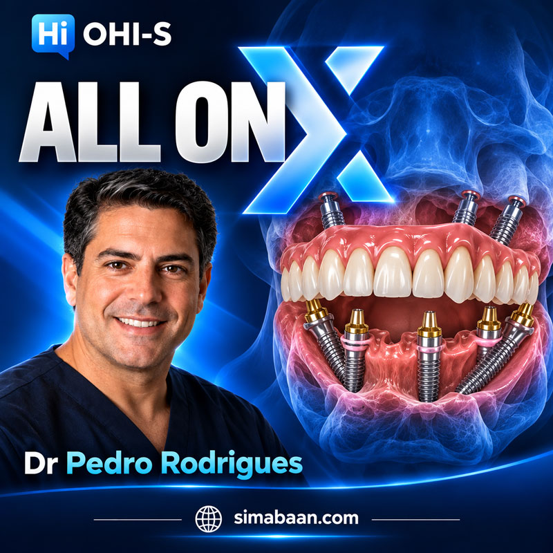 All-on-X-Implant-Lecture-Series-Treatment-Concept-Tilted-Implants--Immediate-Loading--Zero-Bone-Graft--Artificial-Gum آموزش ایمپلنت All-on-X و بازسازی کامل فک با بارگذاری فوری