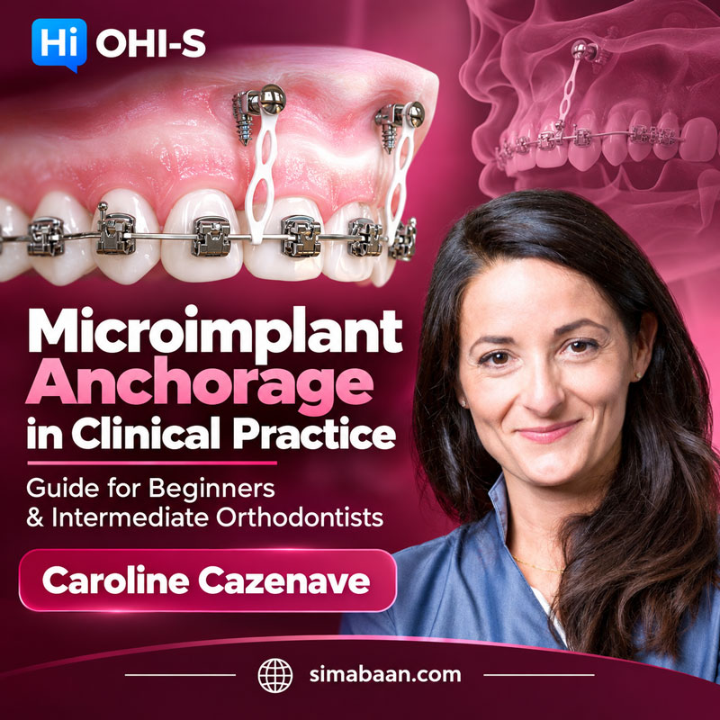 OHI-S-Microimplant-Anchorage-in-Clinical-Practice-Guide-for-Beginners-&-Intermediate-Orthodontists آموزش میکروایمپلنت ارتودنسی و انکوریج اسکلتی در دوره OHI-S
