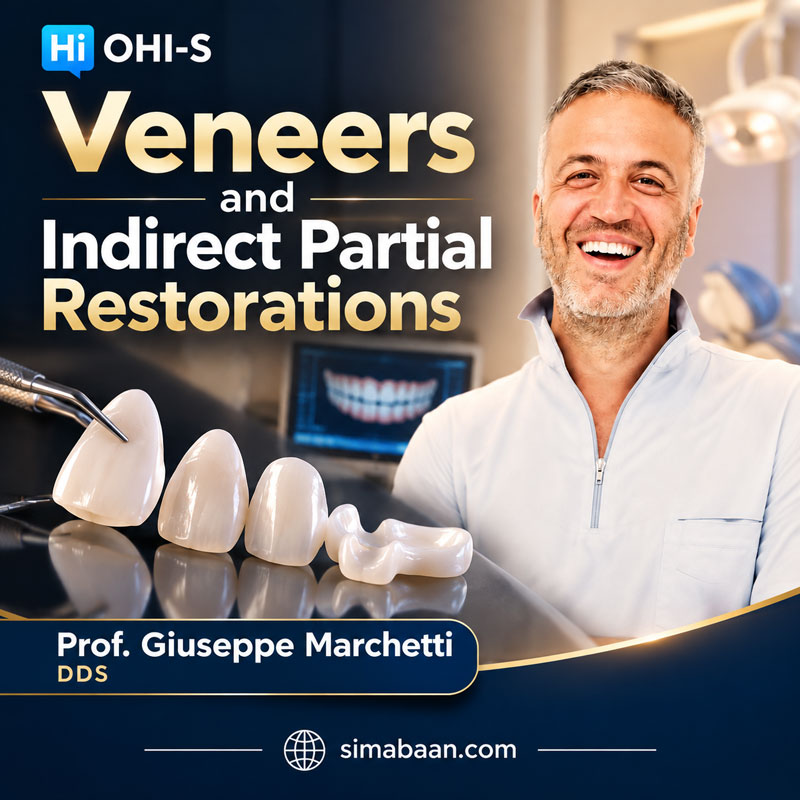 Veneers-and-Indirect-Partial-Restorations آموزش ونیر سرامیکی و ترمیمهای غیرمستقیم دندان در دوره OHI-S
